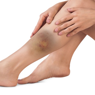 Последствия травм ноги