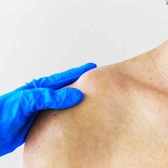Вывих плеча - симптомы, причины и методы лечения в «СМ-Клиника»