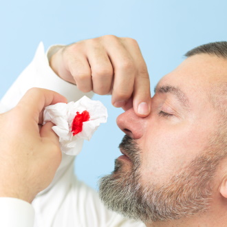 Перелом носа – симптомы, признаки, виды, степени и лечение перелома костейноса у взрослых в «СМ-Клиника»
