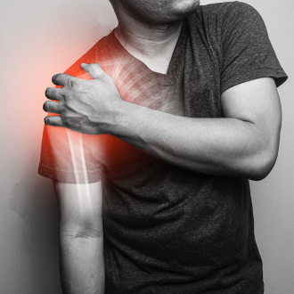 Перелом большого бугорка плечевой кости – симптомы, признаки, виды, степении лечение перелома плеча у взрослых в «СМ-Клиника»