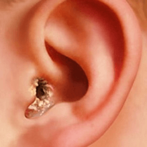 Почему уши чешутся у человека: причины и способы устранения