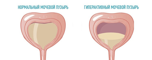 Где Находится Мочевой У Человека Фото