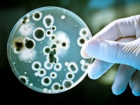 Теперь бактериологические исследования в «СМ-Клиника» проводятся вдвое быстрее