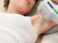 Новая услуга «СМ-Косметология» — лечение гипергидроза на аппарате MiraDry