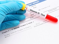 Акция «Анализ на витамин Д со скидкой 49%»