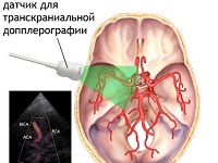 Допплерография сосудов мозга и мрт сосудов головного мозга thumbnail